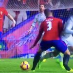 Đối thủ bị gãy gập ống chân khi va chạm với ngôi sao đội Real