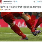 CĐV Liverpool đau lòng vì chấn thương của Coutinho