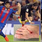 Suarez chê hậu vệ Atletico ẻo lả vì đăng ảnh bàn chân chảy máu