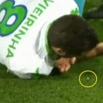 Cầu thủ Wolfsburg gãy rụng răng trong trận đấu Real